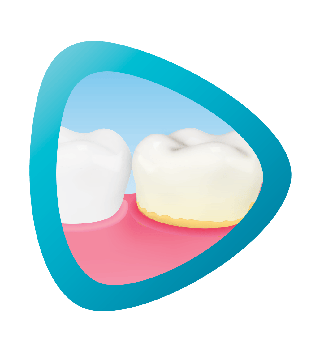 gums not healthy icon