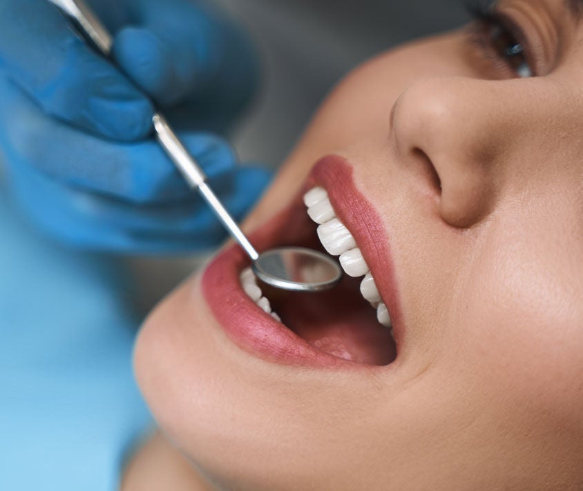 تقرحات الفم