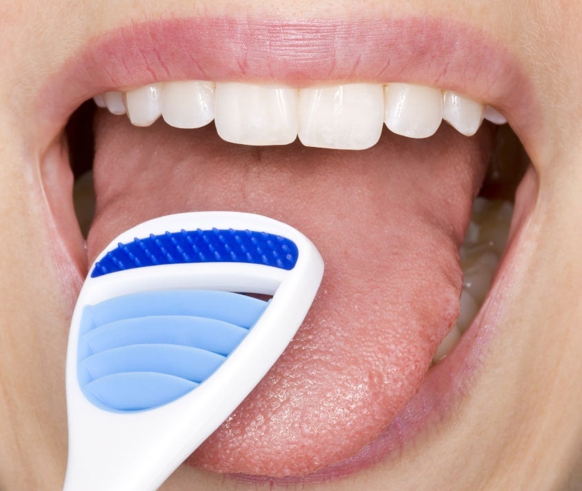 الطبقة البيضاء على اللسان