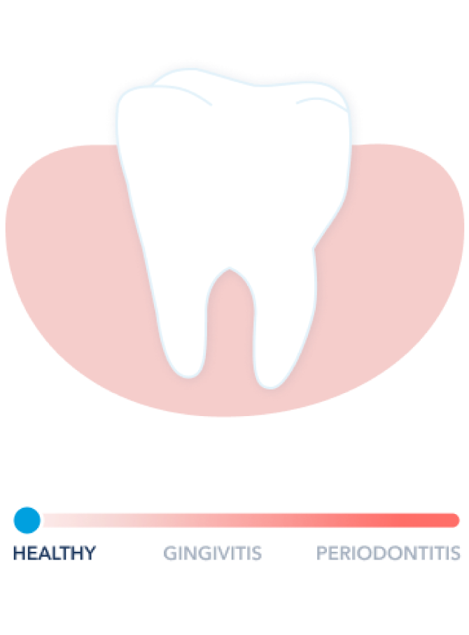 Healthy Gums