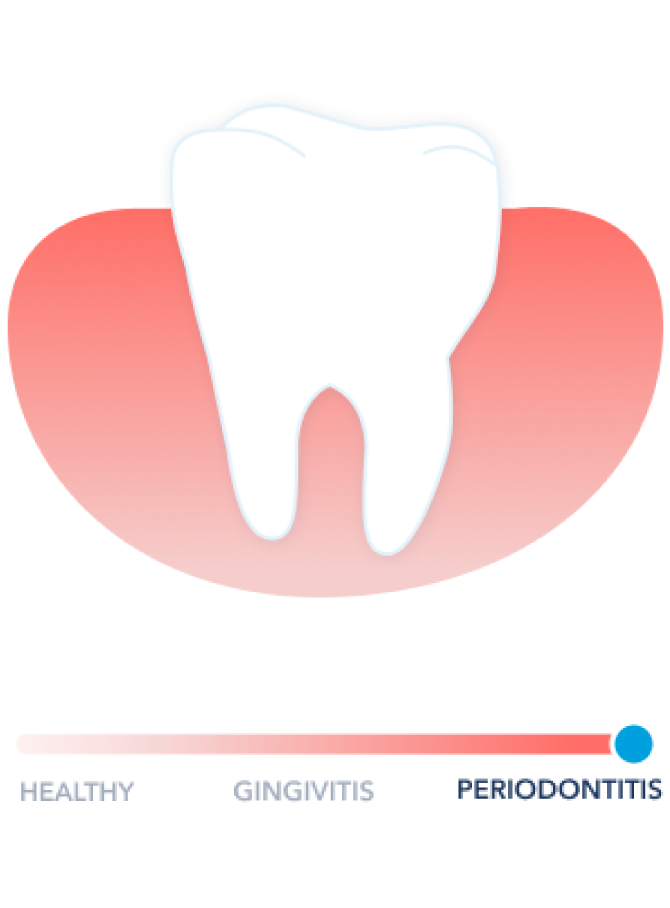 Healthy Gums