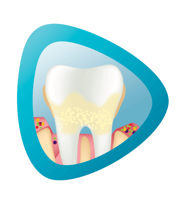 Advanced Gum problems