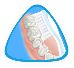 Cleaning of the inner surfaces