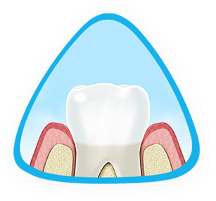 what are the symptoms of gum disease? what are the symptoms of gum disease?